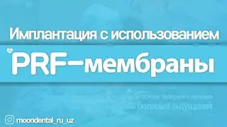 Применение PRF-мембраны | Стоматология МУН | г. Чхонан