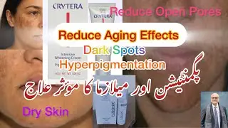 How to reduce Pigmentation, Dark Spots, Melazma ?@cryteracream@cryteracream@fusionhc @fusionhcscrum 