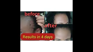 Overnight rice water for FAST hair growth on 4c NATURAL AFRICAN hair/how to use rice water on hair