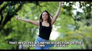 Preservation Breast Augmentation
