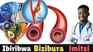 Ibiribwa 12 Bizibura imitsi itwara amaraso mu gihe yazibye ( Biroroshye kubibona)