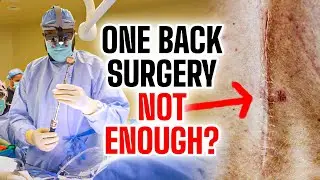 Here is Why Patients Need Multiple Back Surgeries...