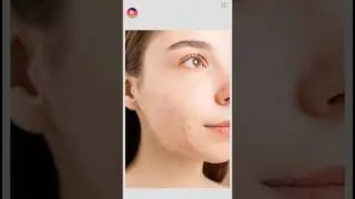 How To Snapseed Healing Tutorial Photo Editing Full Smooth Face #shorts #photoediting #ytshorts