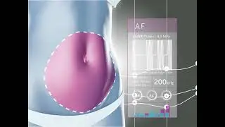 UltraShape Power Software Trailer