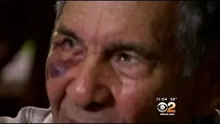 Police Search For Suspect Who Knocked Man, 79, Unconscious At Temple City ATM