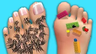 Foot Clinic - Gameplay Walkthrough - All Levels (IOS, Android)