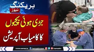 Successful Surgery Separates Conjoined Twins in Saudi Arabia | Incredible Medical Feat  | SAMAA TV