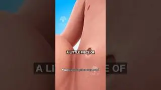 Why Some People Have an Outie Belly Button 🤔 Surgeon Reacts