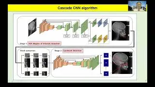 Accuracy of AI-assisted landmark identification in serial lateral cephalograms of surgery patients