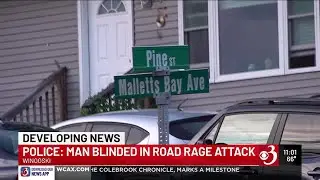 Man blinded in road rage attack, Winooski police say