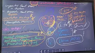 VSD (Ventricular Septal Defect) By Dr Naulej Kumar @Nucleus Medical Media