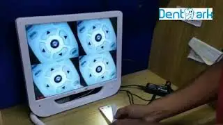 CAMERA WITH MONITOR (17 INCH) (HOW TO USE)