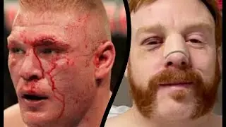 WWE Wrestlers Who Suffered With Illnesses & Disorders | Wrestlers sickness with Disney look