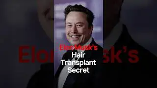 Elon Musk Hair Transplant Explained | Why His Results Lasted for 20+ Years | Elon Musk&rsquo;s Transplant