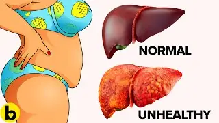 10 Warning Signs That Your Liver Is Full Of Toxins