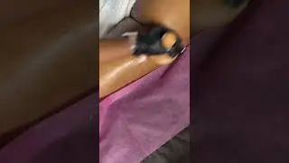 Using the perfect wood therapy tool before a cellulite reduction treatment #woodtherapy