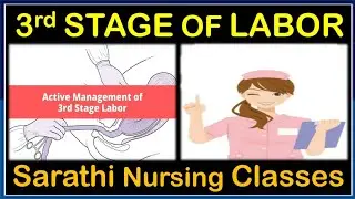 Third Stage Of Labor | Management | Stage Of Labor | Labor Management | Balwant nagar Amli #sarathi