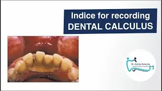 Indice for recording DENTAL CALCULUS/OHI-CALCULUS INDEX/CALCULUS SURFACE INDEX (CSI and CSSI)