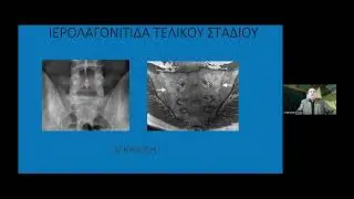 ΛΥΜΠΕΡΟΠΟΥΛΟΣ Κ