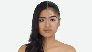 Vitiligo / White Patches Makeup Theory  How to Cover Vitiligo waterproof with Kryolan @Sifatradiantglow