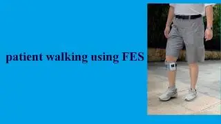 FES Functional Electrical Stimulation for Foot Drop due to Hemiplegia