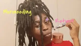 Microneedling & Retwist 