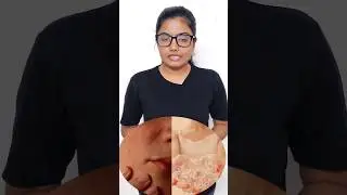 #face #health #beauty #mitalchaudhari #skincare #shorts