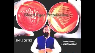 Blood Agar| IsrarAhmedLabknowledge #viral #microbiology #laboratory