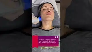 Exilis Elite ✨