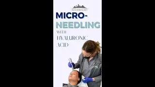Micro-Needling at Dallas Surgical Arts Aesthetic Suites