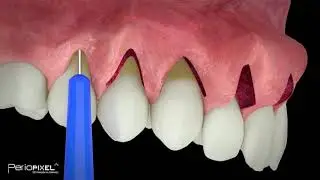 Avance v&iacute;deo completo 