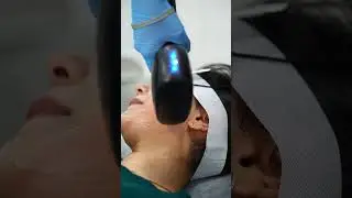 Marshuka shifana | Laser Hair Removal | Maynee Cosmetology Clinic