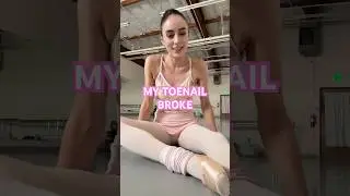 MY TOENAIL BROKE #ballerina#balletcore#reality#real#balletclass#athlete#pointeshoes