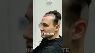 БОЛЬНО ЛИ ПЕРЕСАЖИВАТЬ ВОЛОСЫ?