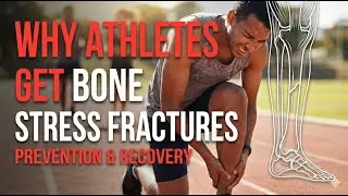 Why Athletes Get Bone Stress Injuries with Dr Nick Birch