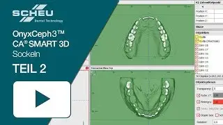 OnyxCeph3™ CA® SMART 3D - Sockeln