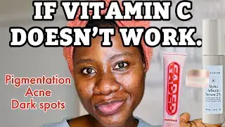 WHY VITAMIN C ISN’T WORKING FOR YOU + BETTER PRODUCTS FOR FADING HYPERPIGMENTATION