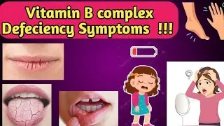 What is vitamin b complex and it's main roles.#vitaminbcomplex 