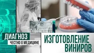 Как изготавливают виниры в цифровых зуботехнических лабораториях | Диагноз