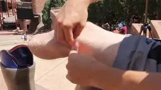 Managing Sweat for Orthotics and Prosthetics