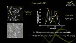 QPI and Phase contrast