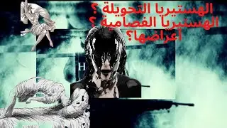 ( هل مانعرفه عنها حقيقي ؟ ( مرض الهستيريا