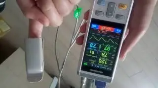 Wuhan UN-medical handheld vital signs monitor---By Shirley Hu.flv