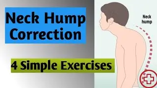 4 Exercises to Correct Neck Hump | Neck Hump Correction #neckhump #correction