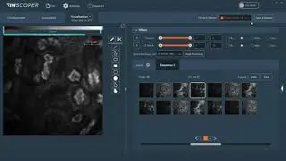 Inscoper I.S. & Jetraw workflow for image acquisition and storage