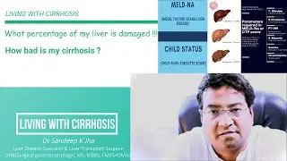 What percent of my liver is damaged ? or How bad is my cirrhosis ?