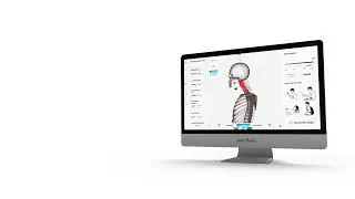 INCORRECT POSTURE: KNOWN RISKS