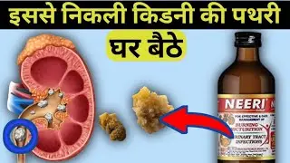 Neeri kft Syrup ke fayde in Hindi | Kidney Stone Treatment | Neeri Syrup