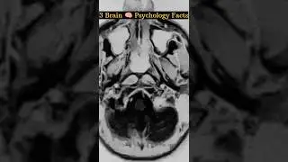 🧠3 Brain Psychology Facts You Won&rsquo;t Believe! 🤯