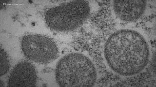 Monkeypox cases rise nationally, experts discuss transmission